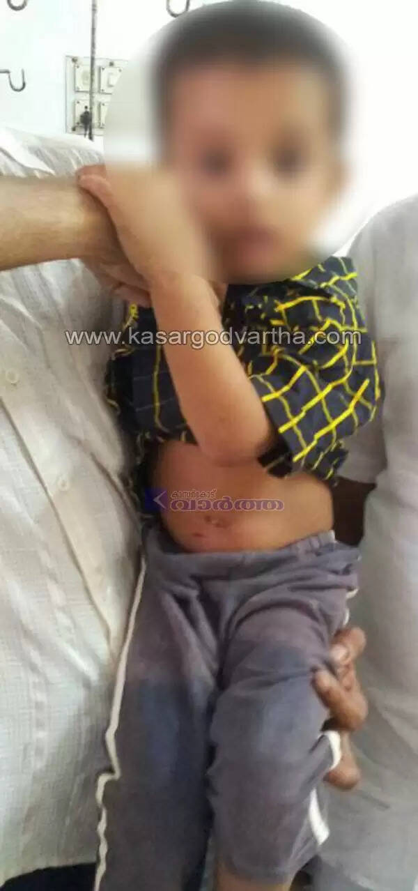 ചങ്ങല പൊട്ടിച്ചെത്തിയ പട്ടി കണ്ണില് കണ്ടവരെയെല്ലാം കടിച്ചു; കുട്ടികളടക്കം 6 പേര് ആശുപത്രിയില്