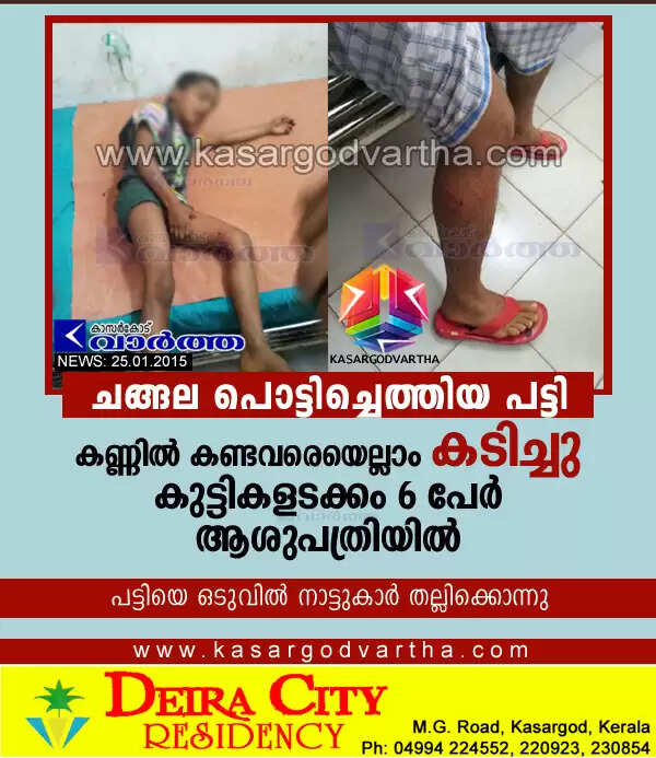ചങ്ങല പൊട്ടിച്ചെത്തിയ പട്ടി കണ്ണില് കണ്ടവരെയെല്ലാം കടിച്ചു; കുട്ടികളടക്കം 6 പേര് ആശുപത്രിയില്