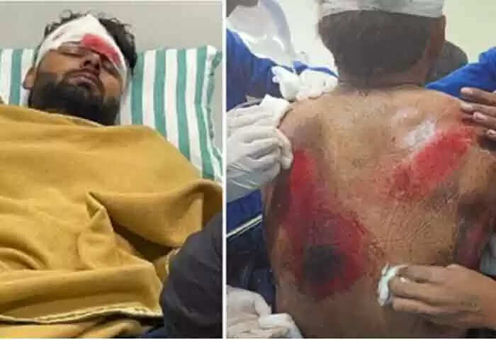 Accident | അപകടത്തിൽ പെട്ട ഋഷഭ് പന്തിനെ പുറത്തെടുത്തത് കാറിന്റെ ചില്ല് തകർത്ത്; തലയിലും കാലുകളിലും പുറകിലും നിരവധി പരിക്കുകൾ; വാഹനം പൂർണമായും കത്തി നശിച്ചു; വീഡിയോ