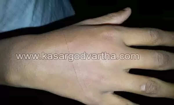 3 വിദ്യാര്ത്ഥികള്ക്ക് അധ്യാപകന് പ്രാകൃത ശിക്ഷ വിധിച്ച സംഭവം ഒതുക്കി