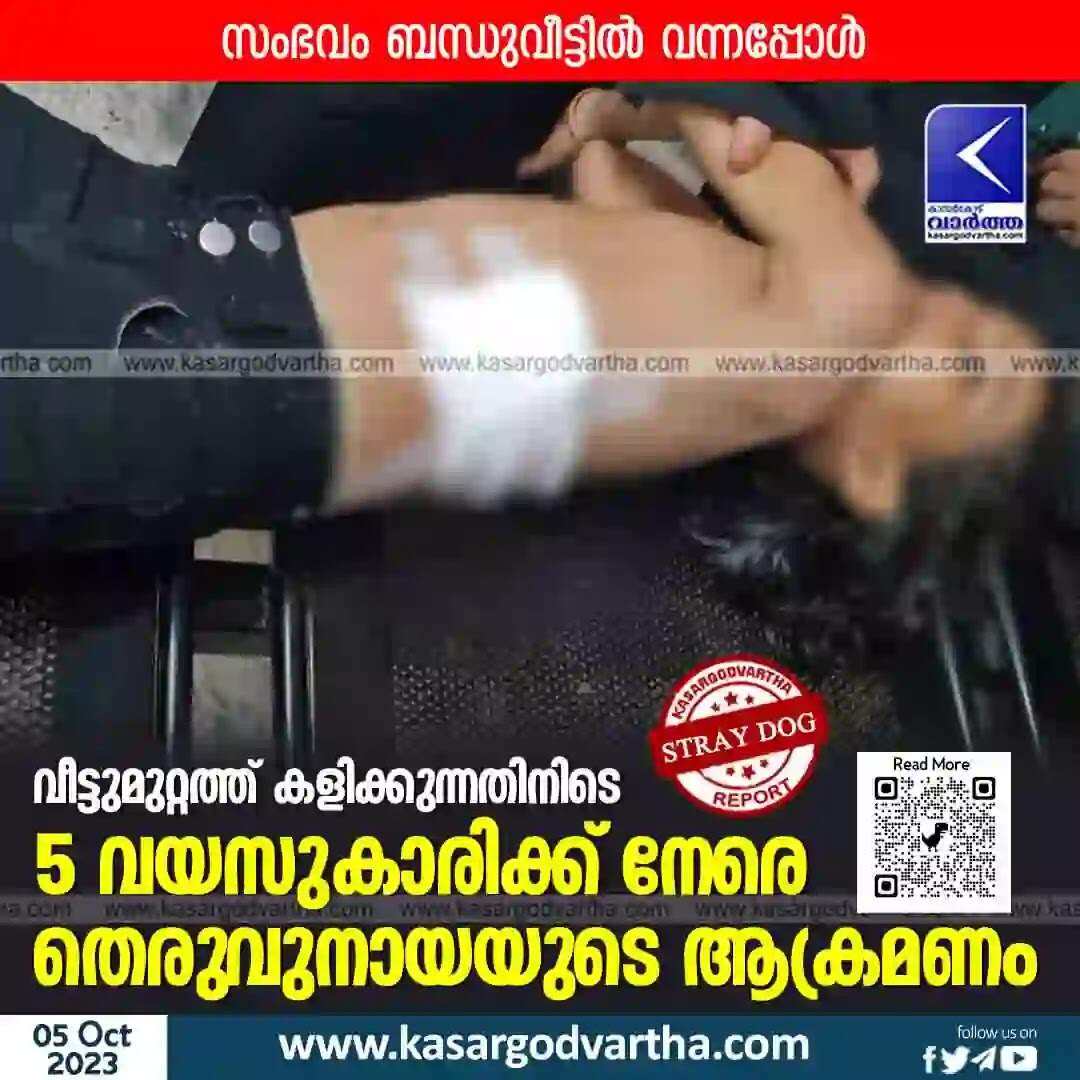 Stray dog | വീട്ടുമുറ്റത്ത് കളിക്കുന്നതിനിടെ 5 വയസുകാരിക്ക് നേരെ തെരുവുനായയുടെ ആക്രമണം