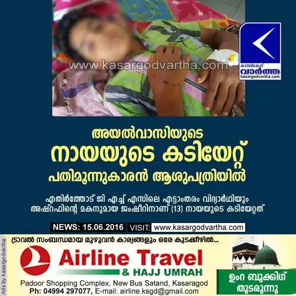 അയല്വാസിയുടെ നായയുടെ കടിയേറ്റ് പതിമൂന്നുകാരന് ആശുപത്രിയില്