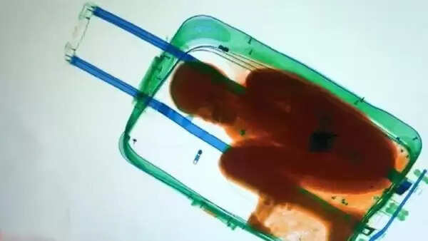 ലോക്ഡൗണ്; കൂട്ടുകാരനെ അപാര്ട്ട്മെന്റിലെത്തിക്കാന് സ്യൂട്ട്കേസിലാക്കി, ഒടുവില്...