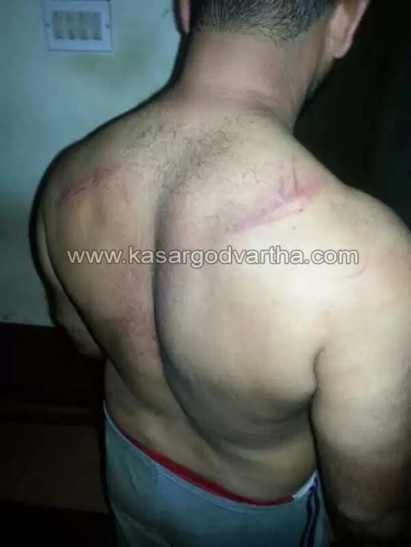 ചെങ്കളയില് ഉപതെരഞ്ഞെടുപ്പിനിടെ ലീഗ് - സി പി എം സംഘര്ഷം; പോലീസ് ഗ്രനേഡ് പ്രയോഗിച്ചു; സി പി എം - ലീഗ് നേതാക്കള്ക്കും യാത്രക്കാര്ക്കും പോലീസുകാര്ക്കും പരിക്ക്