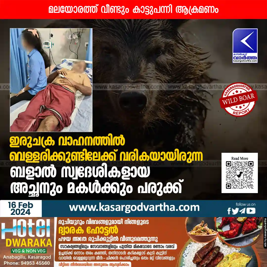 Wild Boar | മലയോരത്ത് വീണ്ടും കാട്ടുപന്നി ആക്രമണം; ഇരുചക്ര വാഹനത്തില് വെള്ളരിക്കുണ്ടിലേക്ക് വരികയായിരുന്ന ബളാല് സ്വദേശികളായ അച്ഛനും മകള്ക്കും പരുക്ക്!