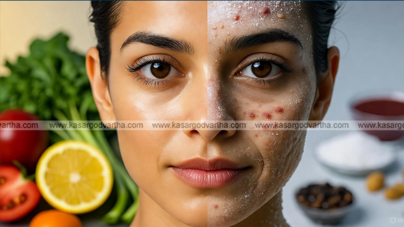 Image of a person eating a lot of sweets and a face with acne and wrinkles
