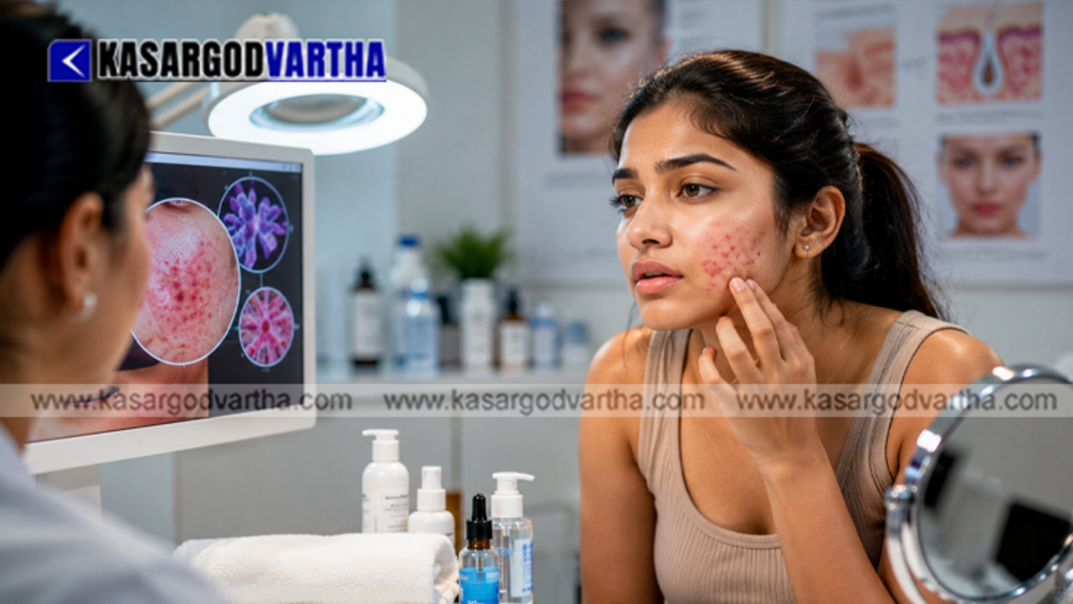 A close-up layout focusing on recurring acne blemishes and skin textures over a cheek area.