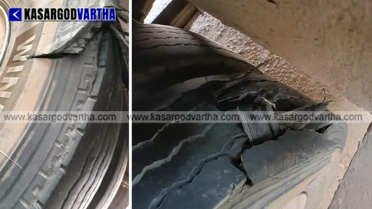 Passenger suffers leg fracture after KSRTC bus tire bursts in Kanhangad; police book driver