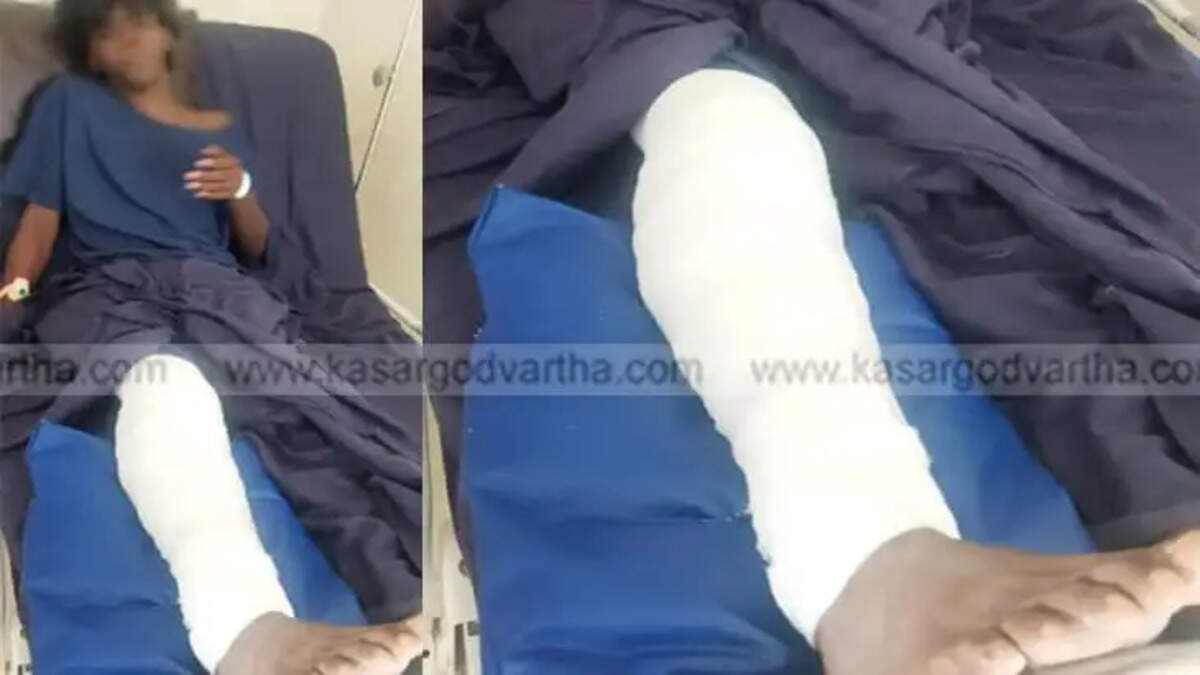 9th Grade Student Attacked by Seniors in Kasaragod; Leg Fractured