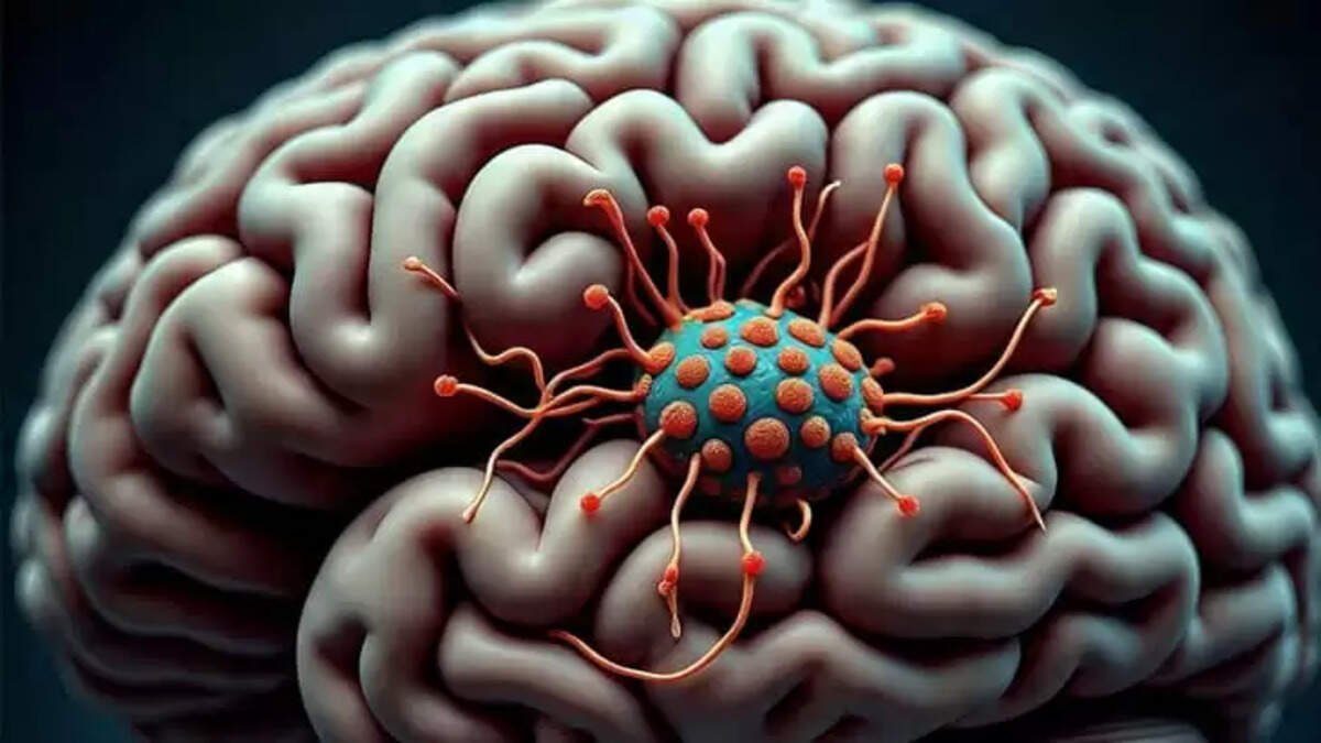 Image Representing Amebic Meningoencephalitis Causes Two Deaths in Kerala