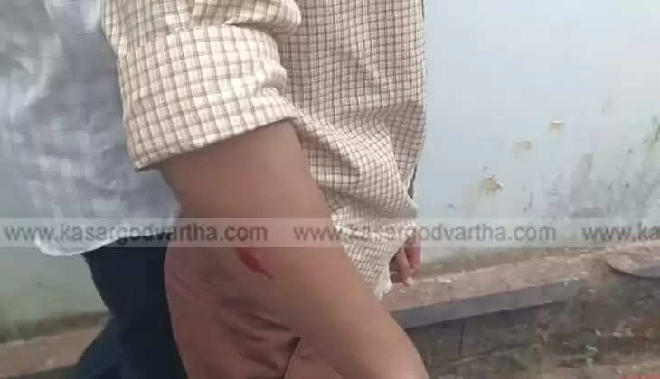 Seven Students Injured in Conflict After Alleged Brutal Ragging at Bekur Higher Secondary School Uppala