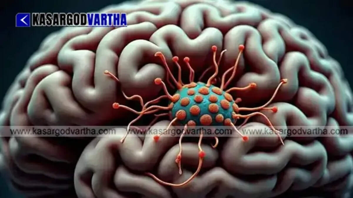 &nbsp;Medical illustration representing amoebic meningoencephalitis health warning