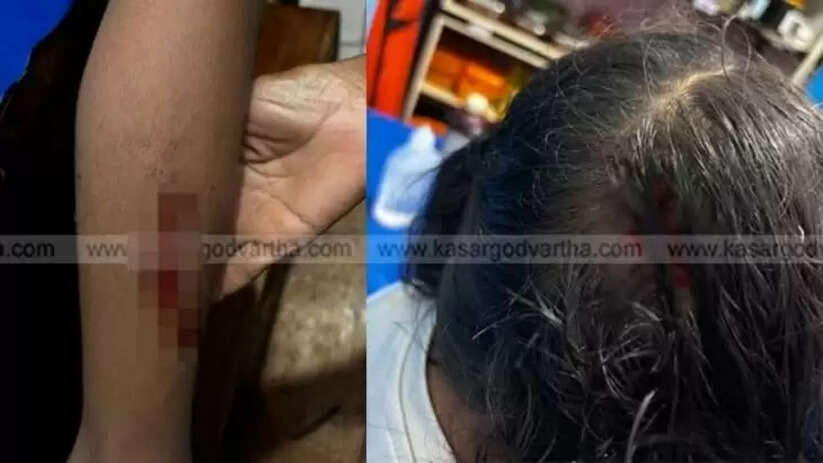 First Grade Student Seriously Injured After Neighbor's Pet Dog Enters House and Attacks in Uduma