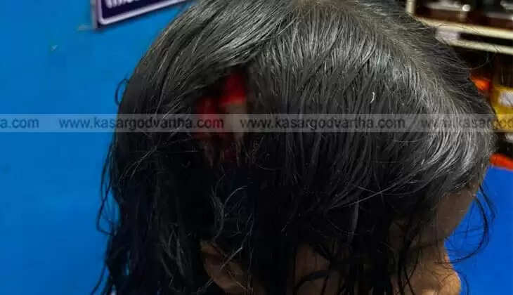 First Grade Student Seriously Injured After Neighbor's Pet Dog Enters House and Attacks in Uduma