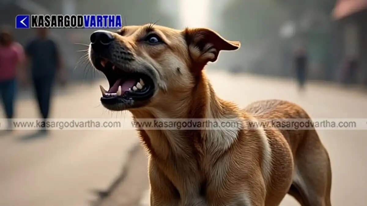 Image Representing 1.5-year-old boy suffers severe injuries after stray dog bites his face in Paivalike
