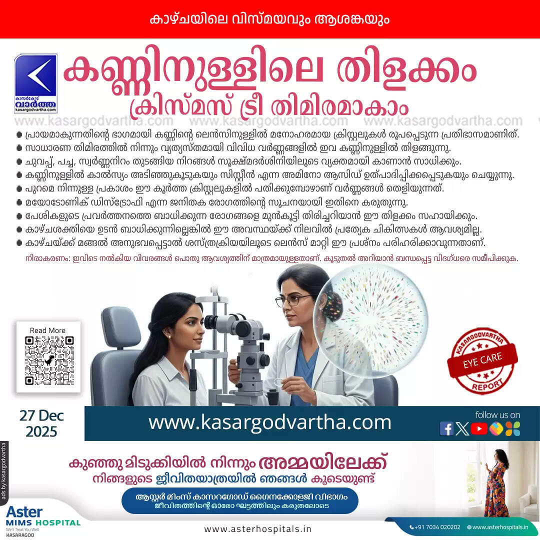 christmas tree cataract eye condition symptoms causes