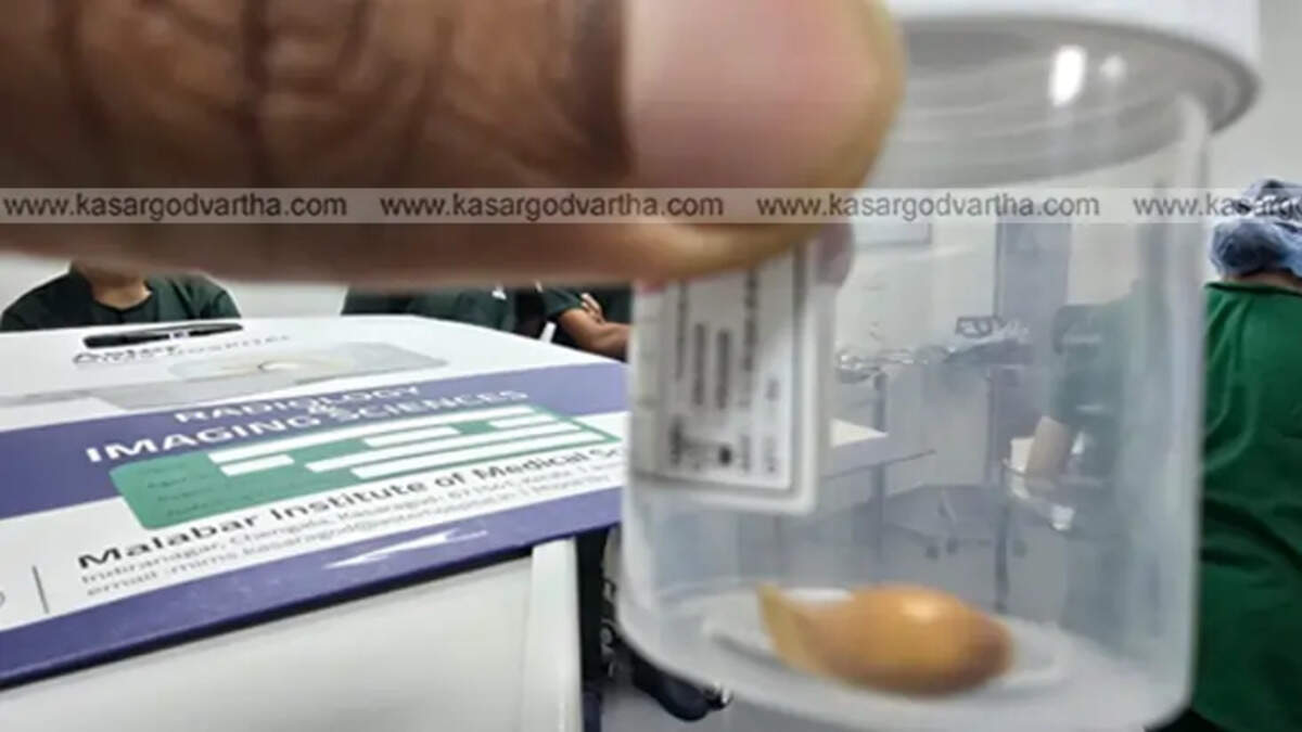 Aster MIMS Kasaragod's successful operation